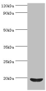 CSB-PA001176ESR2HU