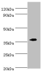 CSB-PA007466ESR2HU
