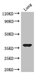 CSB-PA010689LA01HU