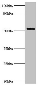 CSB-PA011812ESR1HU