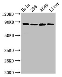 CSB-PA613516LA01HU