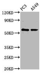 CSB-PA618091LA01HU