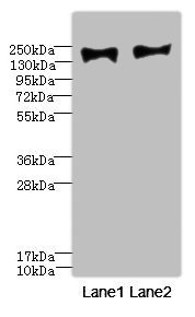 CSB-PA731055ESR1HU