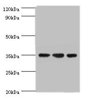 CSB-PA819153ESR1HU