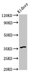 CSB-PA819471LA01HU