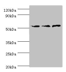CSB-PA854112ESR1HU