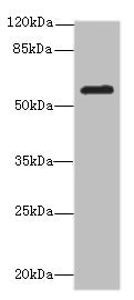 CSB-PA857450ESR1HU