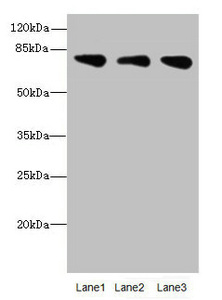 CSB-PA873629ESR2HU