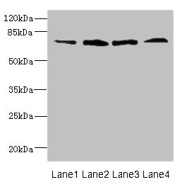 CSB-PA882162LA01HU