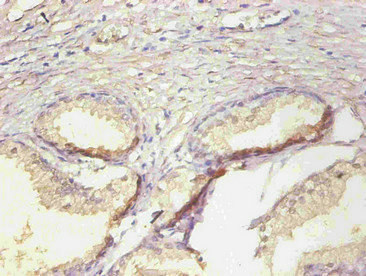 CSB-MA068302A0m