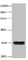 CSB-MA068302A0m