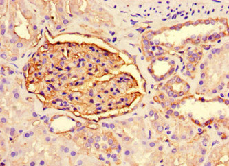 CSB-MA134471A0m