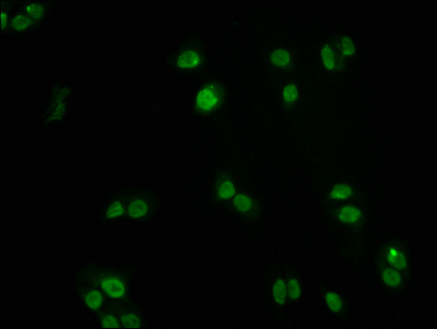 CSB-RA008836A0HU