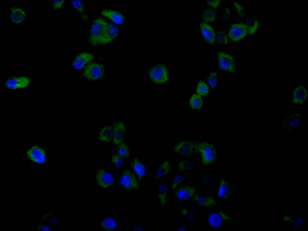 CSB-RA009514MA2HU IF