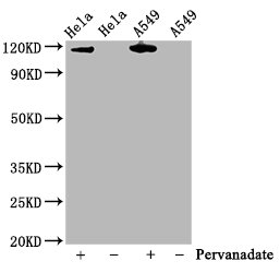CSB-RA011931A100phHU WB