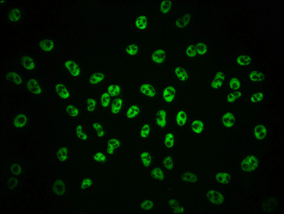 CSB-RA018327A02phHU