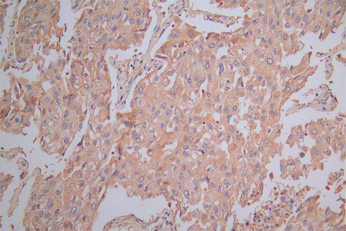 CSB-RA021369MA1HU