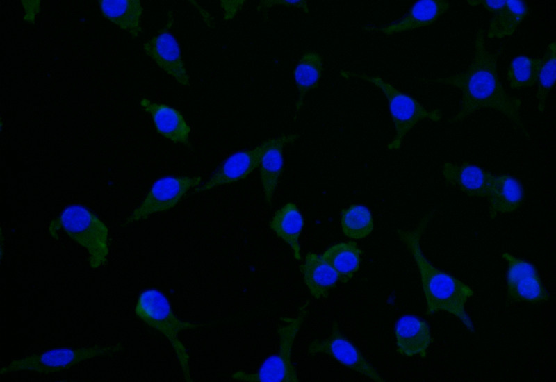 CSB-RA029079A0HU