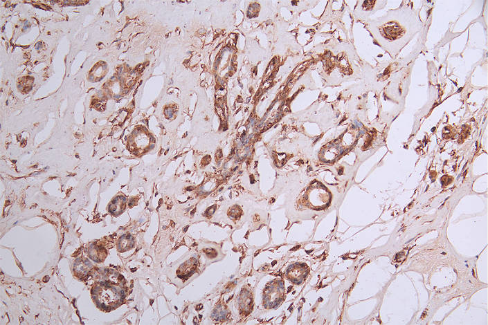 CSB-RA029079A0HU