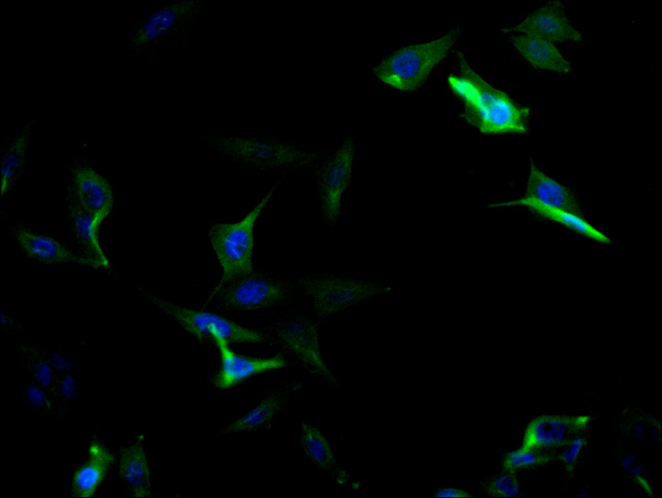 CSB-RA065800A0HU