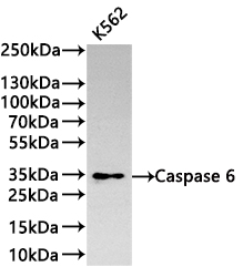 CSB-RA065800A0HU