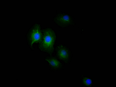 CSB-RA159341A0HU IF