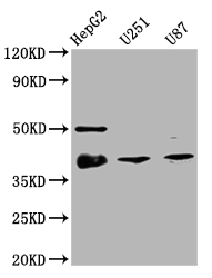 CSB-RA181189A0HU