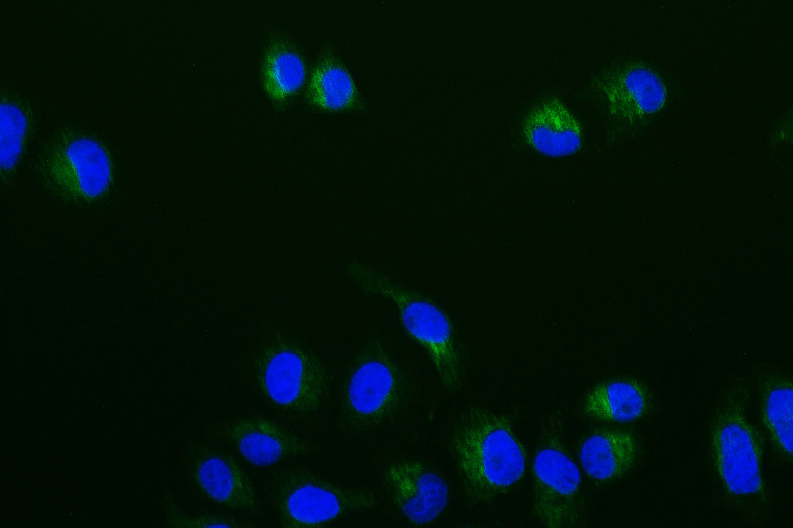 CSB-RA257673A0HU