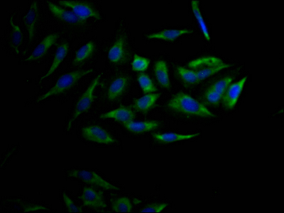 CSB-RA554990A0HU