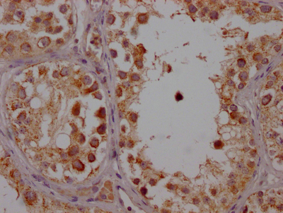 CSB-RA554990A0HU
