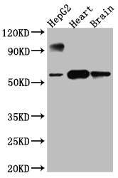 CSB-RA554990A0HU