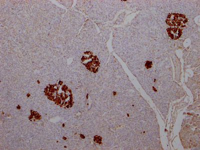 CSB-RA584163A0HU