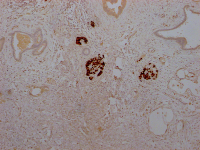 CSB-RA584163A0HU