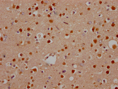 CSB-RA599445A0HU