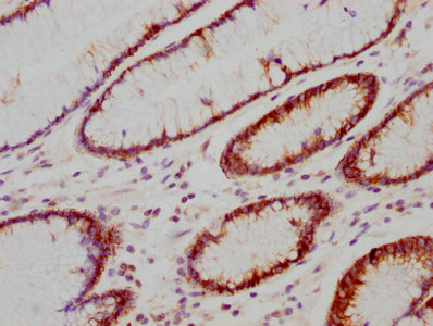 CSB-RA614990A0HU