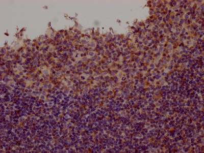 CSB-RA699767A0HU