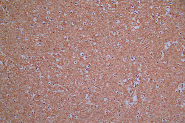 CSB-RA896760MA1HU
