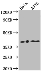 CSB-RA922556A0HU
