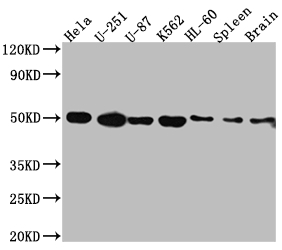 CSB-RA929304A0HU