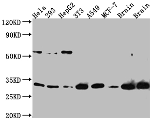 CSB-RA935337A0HU
