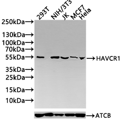 CSB-RA974628A0HU
