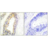 CSB-PA799270