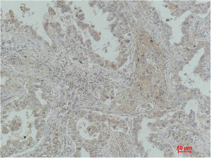 CSB-MA080225