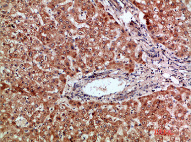 CSB-PA389153