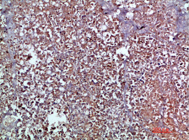 CSB-PA389153