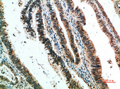 CSB-PA412681