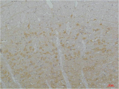 CSB-PA413190