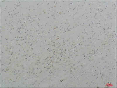CSB-PA413190