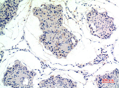 CSB-PA890812