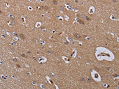 CSB-PA037047